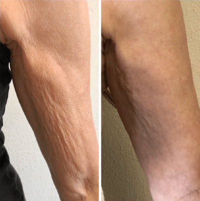 GlowVital Anti-Cellulite Massage Oil