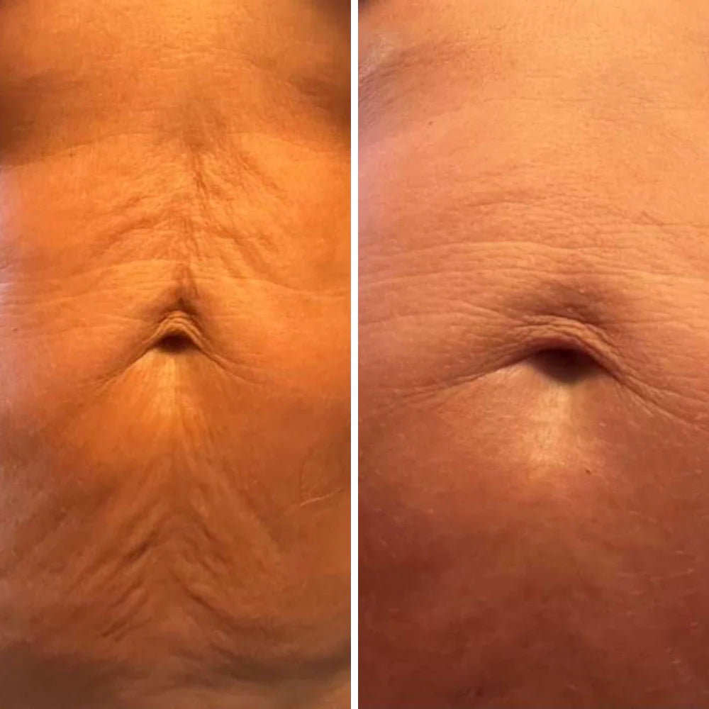 GlowVital Anti-Cellulite Massage Oil